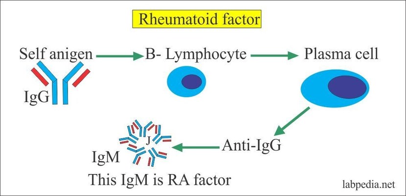 Rheumatoid Factor RF   240d113dd1 